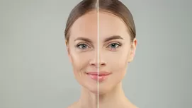 ¿Por qué tienes el rostro grasoso y cómo evitarlo?