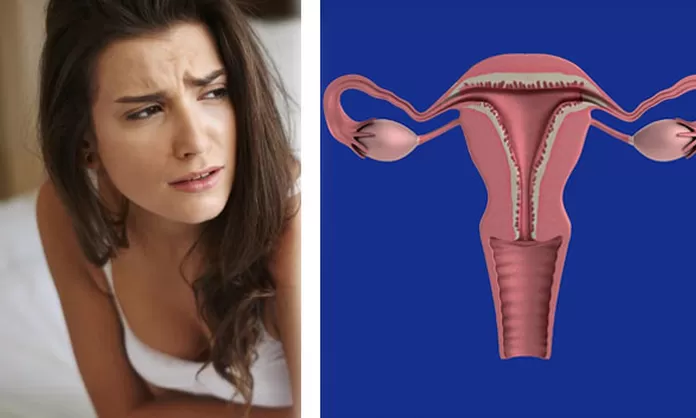 Cinco Causas De Posibles Sangrados Entre Periodos Menstruales