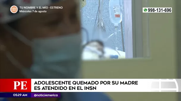 Adolescente quemado por su madre recibe atención en el INSN. Foto: América Noticias