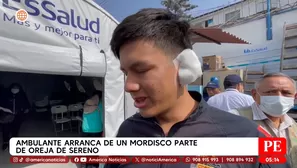 Ambulante arranca de un mordisco parte de oreja a sereno de Chosica. Foto y video: América Noticias