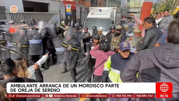 Ambulante arranca de un mordisco parte de oreja a sereno de Chosica. Foto: América Noticias