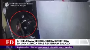 Hombre disparó contra policías en clínica de Surco.