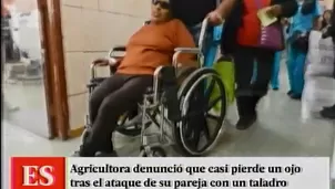 Mujer casi pierde un ojo tras ser atacada por su pareja. Foto: captura de TV