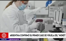 Argentina confirmó su primer caso de viruela del “mono” - Noticias de mauricio-diez-canseco