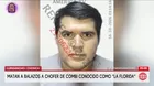 Asesinan a balazos a chofer de combi en Lurigancho-Chosica