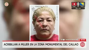 Asesinan a mujer de nueve disparos en el Callao. Foto y video: América Noticias