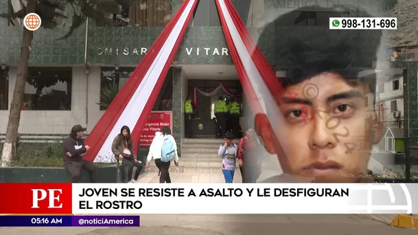 Joven fue desfigurado en Ate. Foto: América Noticias