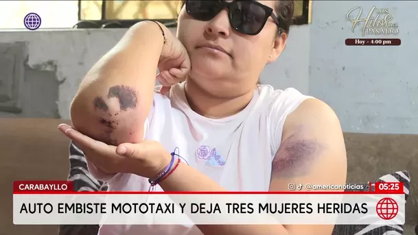 Auto embiste mototaxi y deja tres mujeres heridas en Carabayllo. Foto: América Noticias Auto embiste mototaxi y deja tres mujeres heridas en Carabayllo. Foto: América Noticias