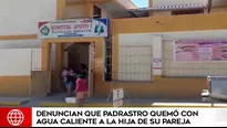 Niña fue quemada en Bagua.