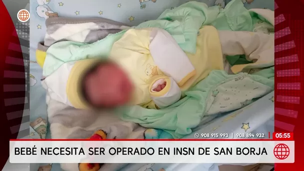 Bebé de un mes necesita urgente operación en el INSN de San Borja. Foto: América Noticias