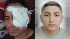 Carabayllo: Sujeto desfigura el rostro a un joven con una botella