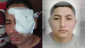 Carabayllo: Sujeto desfigura el rostro a un joven con una botella/ Video y Foto: América Noticias