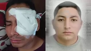 Carabayllo: Sujeto desfigura el rostro a un joven con una botella/ Video y Foto: América Noticias