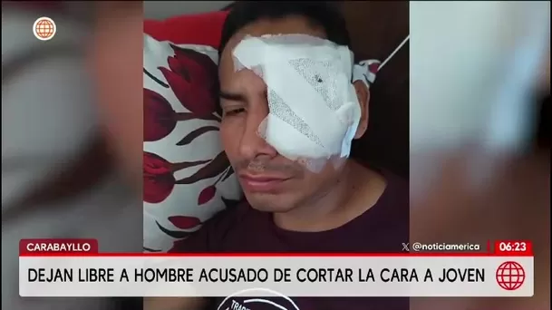 Sujeto desfigura el rostro a un joven en discoteca de Carabayllo y es liberado por la policía/ América Noticias Sujeto desfigura el rostro a un joven en discoteca de Carabayllo y es liberado por la policía/ América Noticias