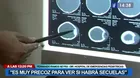 Caso de menor agredida con ladrillo: Médico señala que es precoz saber si tendrá secuelas
