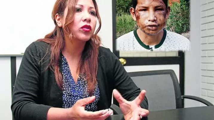 Herald Pacheco fue confundido con delincuente y golpeado durante tres horas Herald Pacheco fue confundido con delincuente y golpeado durante tres horas