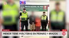 Chimbote: Padres acusados de fracturar brazos y pierna de su bebé
