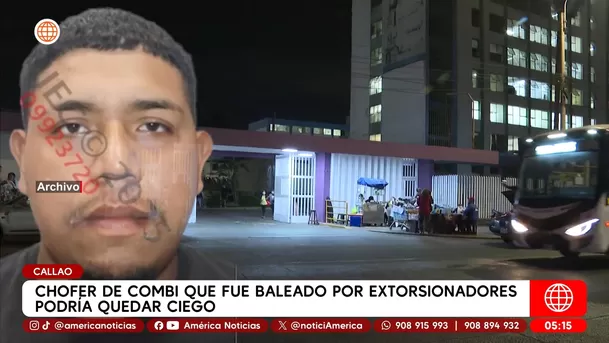 Chofer de combi que fue baleado por extorsionadores podría queda ciego. Foto: América Noticias Chofer de combi que fue baleado por extorsionadores podría queda ciego. Foto: América Noticias