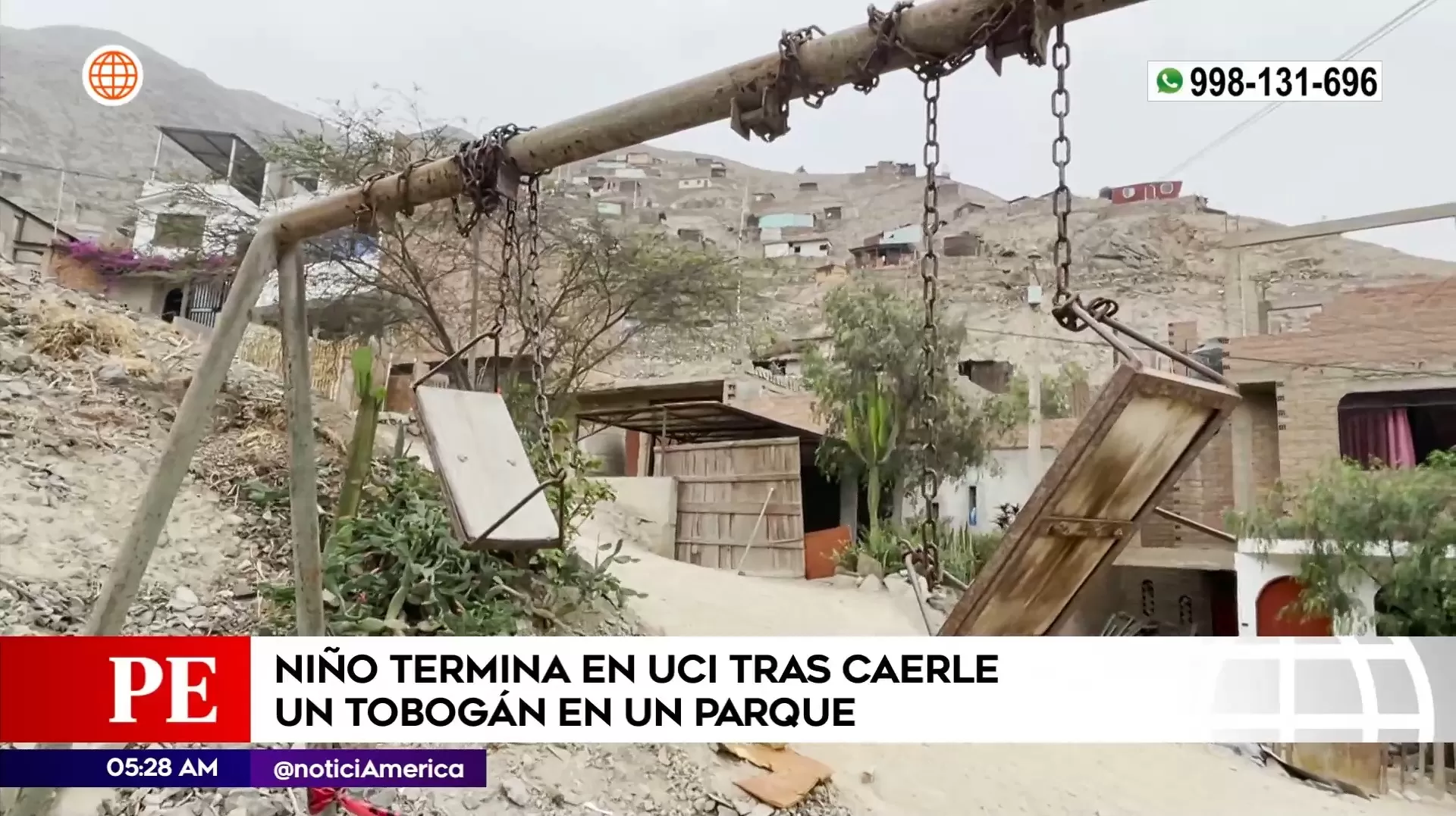 NIño grave tras caerle tobogán en Chosica. Foto: América Noticias