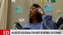 Mujer fue golpeada en Comas. 