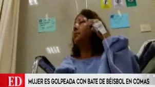 Mujer fue golpeada en Comas. 