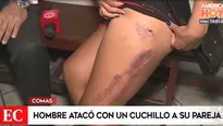 Una profunda herida en la pierna, lesiones en el cuello y daño psicológico mayúsculo