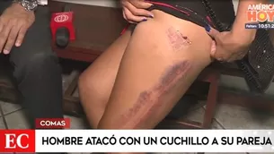 Una profunda herida en la pierna, lesiones en el cuello y daño psicológico mayúsculo