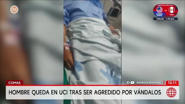 Comas: Vándalos atacan a un hombre y difunden el video en redes. Foto: América Noticias Comas: Vándalos atacan a un hombre y difunden el video en redes. Foto: América Noticias