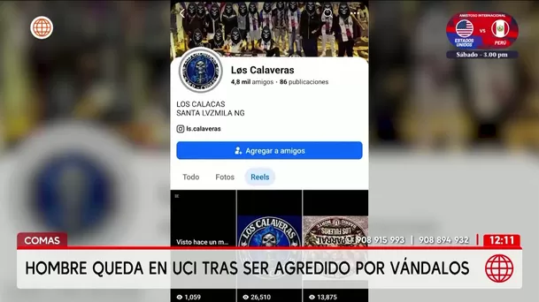 Comas: Vándalos atacan a un hombre y difunden el video en redes. Foto: América Noticias Comas: Vándalos atacan a un hombre y difunden el video en redes. Foto: América Noticias