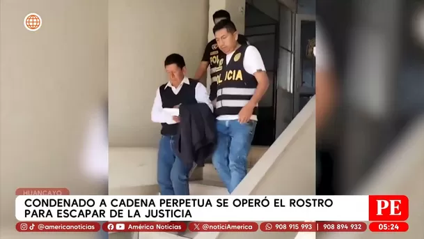 Condenado a cadena perpetua se operó el rostro para escapar de la justicia en Huancayo. Foto: América Noticias Condenado a cadena perpetua se operó el rostro para escapar de la justicia en Huancayo. Foto: América Noticias