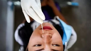 Sanamente con el Dr. Elmer Huerta. Foto: Reuters / Video: América Noticias