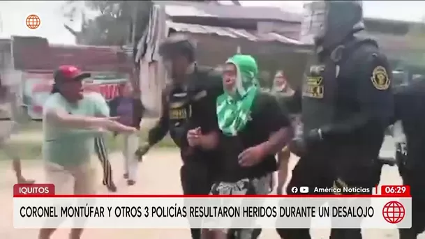 Coronel Montúfar y tres policías resultan heridos en Iquitos. Foto: América Noticias