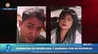 Cosmiatra lucha por su vida tras ser quemada por su expareja