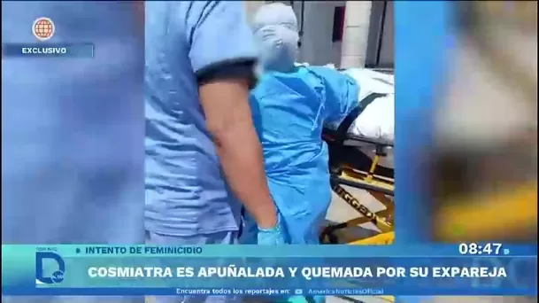 Joven cosmiatra quemada por expareja tiene muerte cerebral/ Domingo al Día