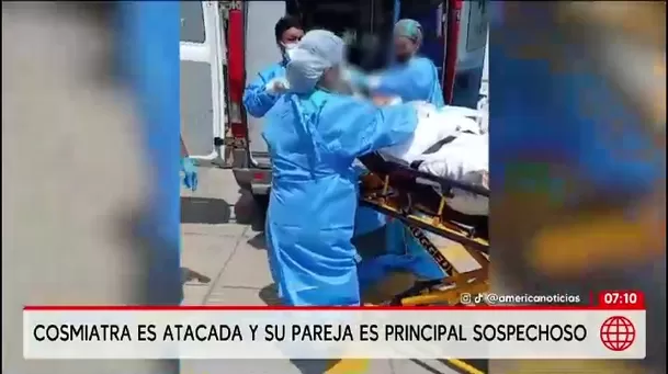 Cosmiatra lucha por su vida tras ser quemada en Surquillo/ América Noticias