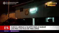 Hombre quemó a su hija.