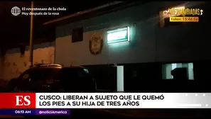 Hombre quemó a su hija.