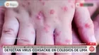 Detectan casos de virus coxsackie en colegios de Lima