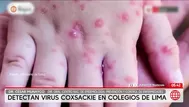 Detectan casos de virus coxsackie en colegios de Lima
