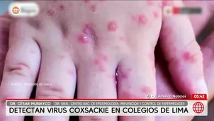 Detectan casos de virus coxsackie en colegios de Lima Metropolitana. Foto y video: América Noticias