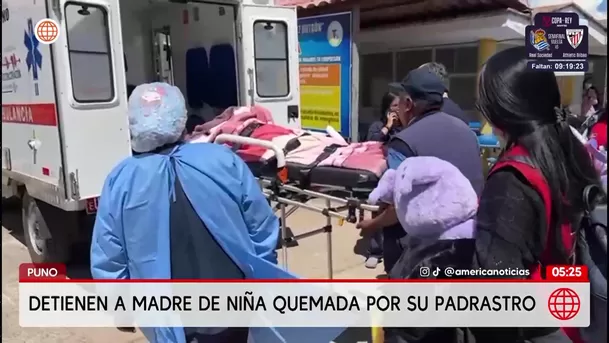 Detienen a la madre de la niña quemada por su padrastro en Puno. Foto: América Noticias Detienen a la madre de la niña quemada por su padrastro en Puno. Foto: América Noticias