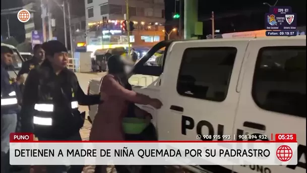 Detienen a la madre de la niña quemada por su padrastro en Puno. Foto: América Noticias Detienen a la madre de la niña quemada por su padrastro en Puno. Foto: América Noticias