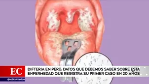 Difteria en Perú.