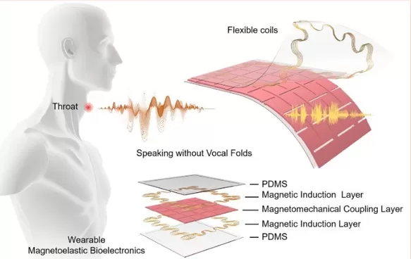 Dispositivo portátil asistido por IA permite hablar sin cuerdas vocales. Foto: UCLA