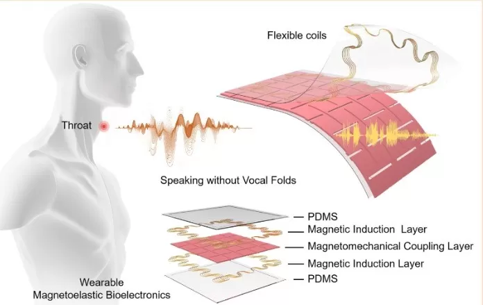 Dispositivo portátil asistido por IA permite hablar sin cuerdas vocales. Foto: UCLA