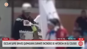 Escolar de 9 años sufre quemaduras de tercer grado en Piura. Foto y video: América Noticias