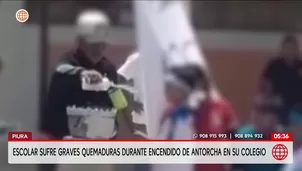 Escolar de 9 años sufre quemaduras de tercer grado en Piura. Foto y video: América Noticias