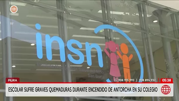 Escolar de 9 años sufre quemaduras de tercer grado en Piura. Foto: América Noticias Escolar de 9 años sufre quemaduras de tercer grado en Piura. Foto: América Noticias