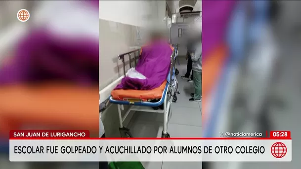 Escolar fue atacado a golpes y acuchillado en San Juan de Lurigancho. Foto: América Noticias