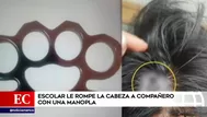 Escolar le rompió la cabeza a su compañero con una manopla de acero